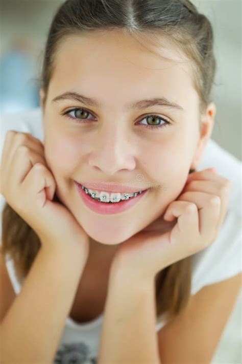 close up portrait of smiling teenager girl showing dental braces isolated on white background