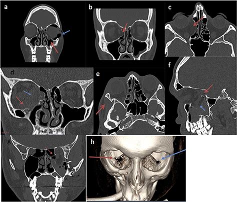 Frontiers A Functional Radiological And Soft Tissue Classification To
