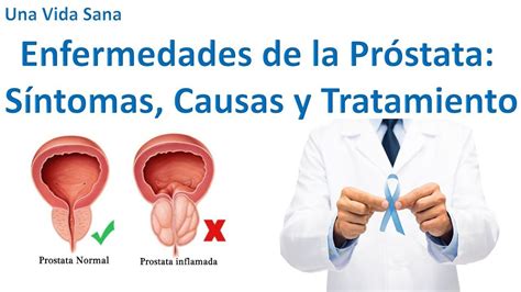 Enfermedades De La Próstata Síntomas Causas Y Tratamiento Vida Sana