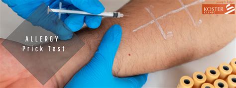 Skin Allergy Tests Prick Test Patch Test In Dubai Koster Clinic