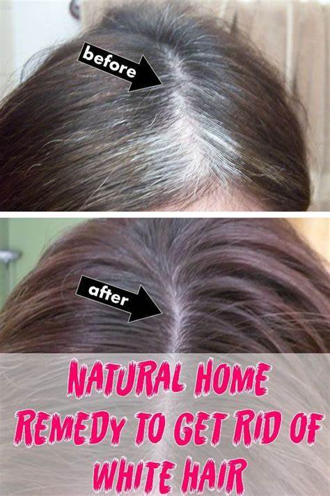 Step by step instructions to Get Rid Of Premature White Hair: Causes, Natural
