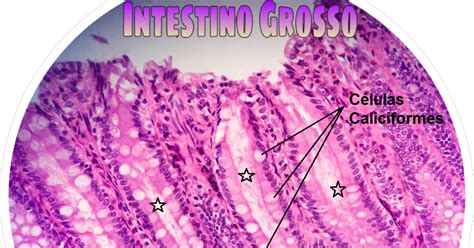 Histologia Lâminas Intestino Grosso