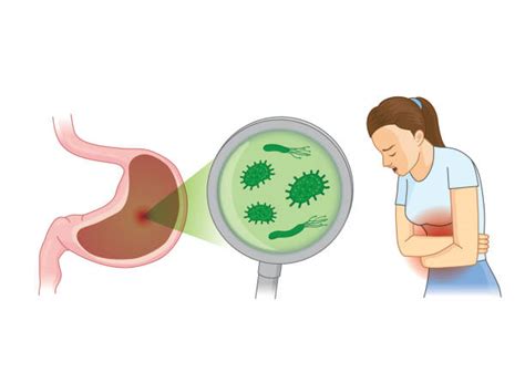 Gastroenteritis Bacteria Illustrations Royalty Free Vector Graphics
