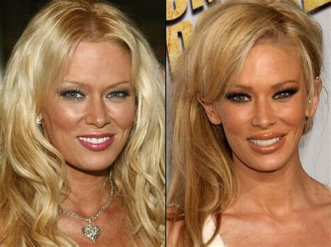 Celebrities Before And After A Plastic Surgery 21 Pics