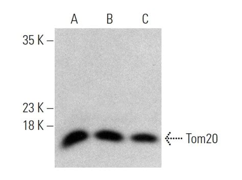 The antibody is conjugated to horseradish peroxidase (hrp) and is commonly used for wb, ihc and elisa. mouse anti-rabbit IgG-HRP Secondary Antibody | SCBT ...