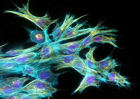 Fibroblast Cells Fluorescent Micrograph Photograph By Dr Torsten Wittmann