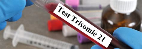 Bluttest Auf Trisomie 21 Sollte Nur Unter Bestimmten Voraussetzungen