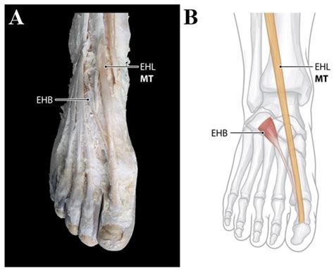 Ijerph Free Full Text Anatomical Characteristics Of Extensor