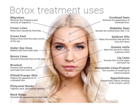 Injections Botox Geneva Dr Lucas Plastic Surgery