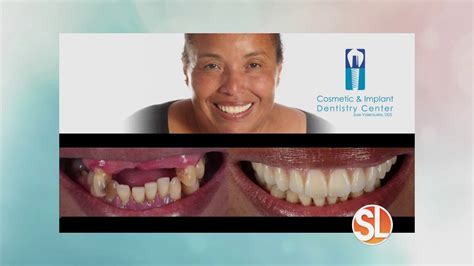 Cosmetic Implant Dentistry Center Talks About Dental Implants YouTube