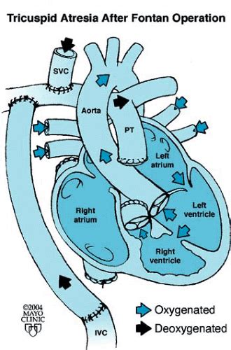 Diagrammatic Representation Of Heart