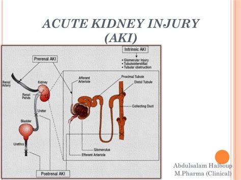 Acute Kidney Injury Definition Diagnosis And Epidemiology Legitimaris