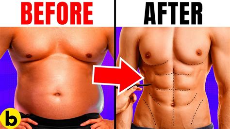 10 Bizarre But Popular Plastic Surgery Procedures You Didnt Know Existed Youtube