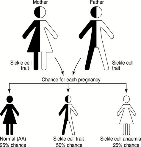 Fortnightly Review Neonatal Screening For Sickle Cell Disorders What About The Carrier Infants