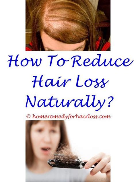 How To Stop Genetic Hair Loss Naturally Tips And Tricks Best Simple