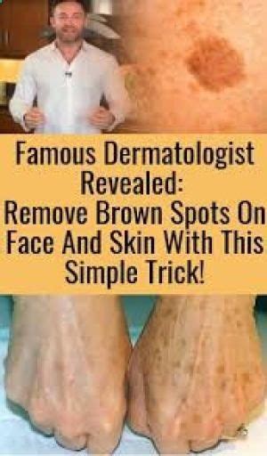 The Best Natural And Most Effective Natural Remedies To Remove Brown