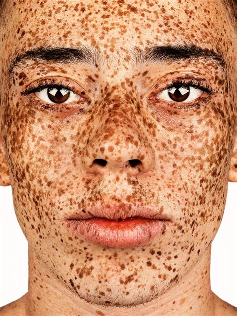 FRECKLES PHOTOGRAPHY EXHIBITION SWEDEN BY PHOTOGRAPHER BROCK ELBANK