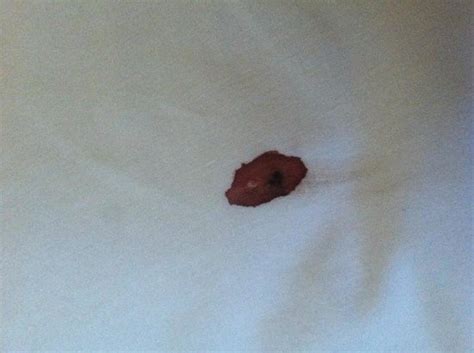 •), which are bed bug excrement when not feeding, bed bugs hide in a variety of places. Blood stains on our sheets! - Picture of Travelodge ...