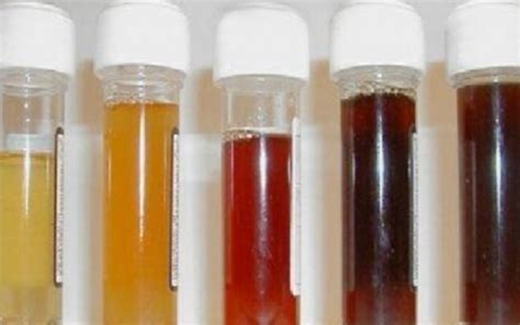 The Color Of Urine Reveals The Condition Of The Body