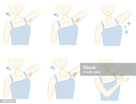 Womens Underarm Skin Problem Set Stock Illustration Download Image