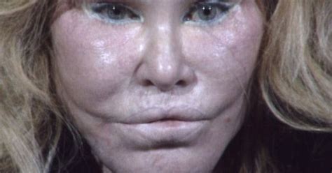 Catwoman Jocelyn Wildenstein S Changing Face And Life Story As She S