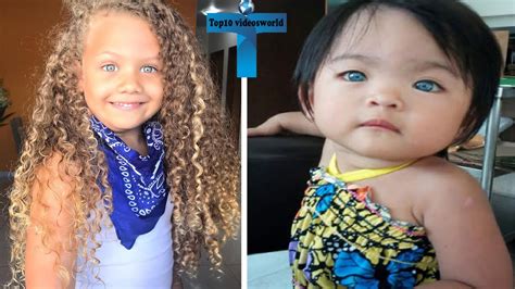 Top 10 Most Unbelievable And Unusual Kids With Amazing Features In The