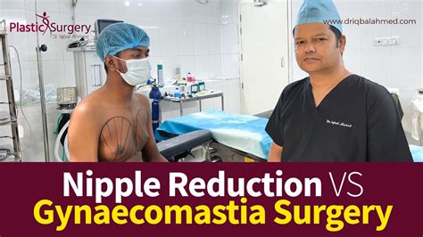 Nipple Reduction Vs Gynecomastia Nipple Reduction Surgery Gynecomastia Surgery Youtube