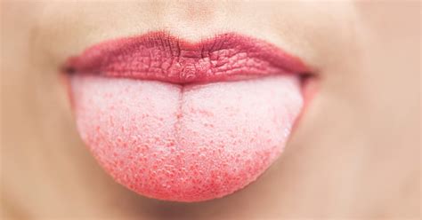What A White Tongue And Other Tongue Troubles Are Really Saying Brush Your Tongue Florida