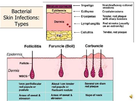 Pathology Of Skin Common Disorders