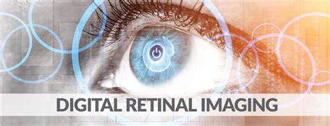 Digital Retinal Imaging Eyecare Plus Optometrist Cranbourne