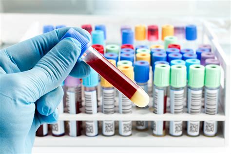 Mandated Employee DOT Drug Testing Rules | SAP Referral Services - SAP