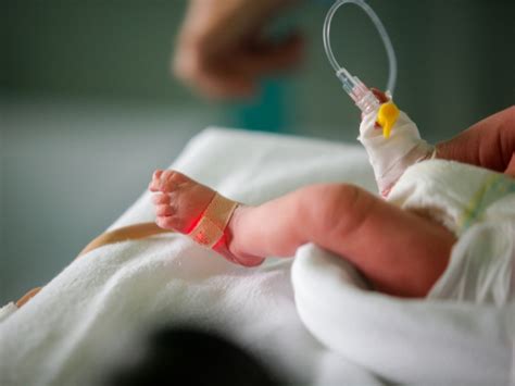 Baby Born At 36 Weeks Survival Rate And Complications