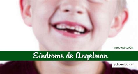 🥇 Síndrome De Angelman 🥇 Todo Lo Que Necesitas Saber Ya