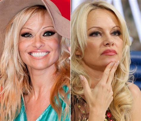 Pamela Anderson Su Incre Ble Cambio Tras Los Vigilantes De La Playa