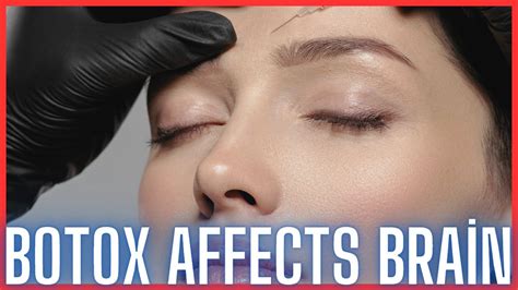 Botox May Affect Brain Activity Youtube