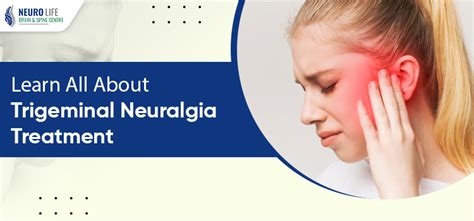 What Is Trigeminal Neuralgia Its Causes Symptoms And Treatment