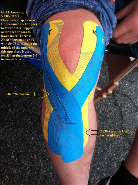 View topic - Full knee app version 4 | Knee taping, Knee injury, Knee 