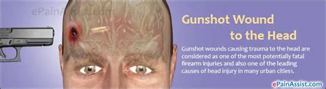 Gunshot Wound To The Head