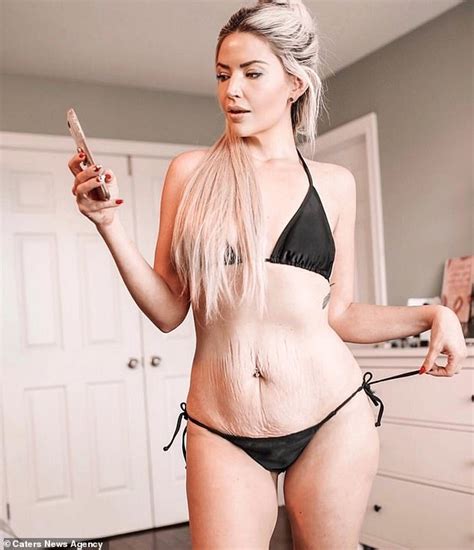 Mum Of Three Shows Off Her Cellulite And Stretch Marks In Snaps