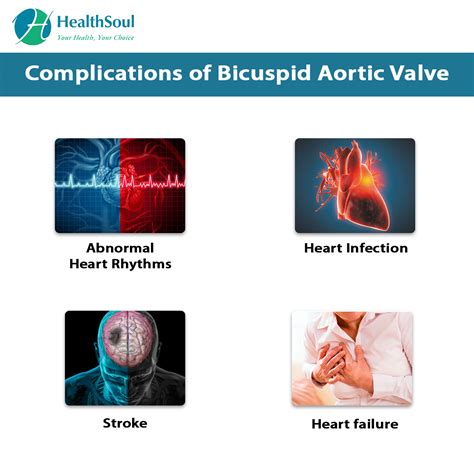 Bicuspid Aortic Valve Healthsoul