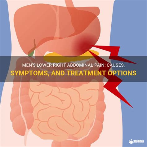 Mens Lower Right Abdominal Pain Causes Symptoms And Treatment