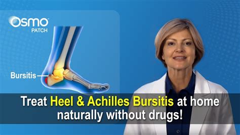 Achilles Tendon Bursitis