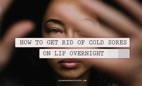 How To Get Rid Of Cold Sores On Lip Overnight 365 Days Of Positivity