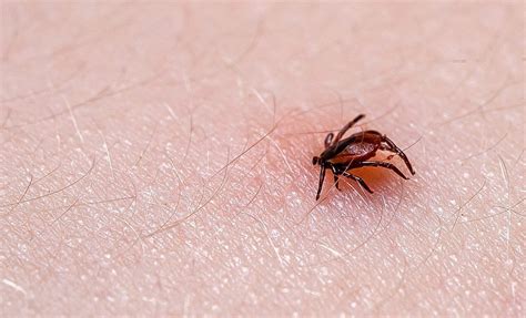 Tick Bite Sign And Symptom 5 First Aid Methods 3 Treatments Pest Wiki