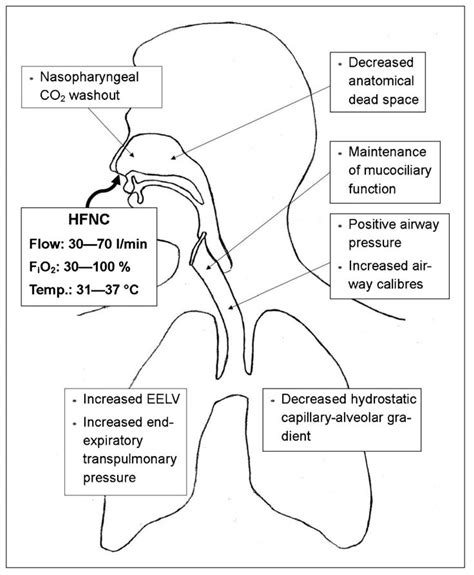 Capnography traces derived from a sample port at the tip of a modified co2/o2 guedel airway were more accurate than those obtained from a co2/o2 nasal cannula. High Flow Nasal Cannula Putative beneficial mechanisms ...