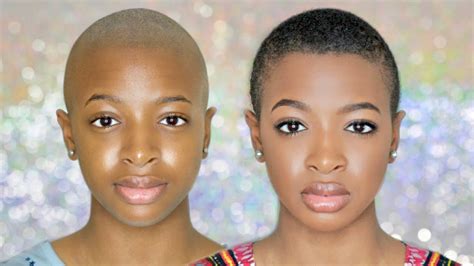 Hair transplant procedures have gotten much better and today, surgeons can create a full, natural looking head of hair. Shaved hair growth - Naked photo