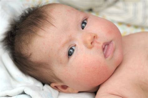 Baby Mit Dermatitisproblem Des Hautausschlags Überstürztes Leiden Der