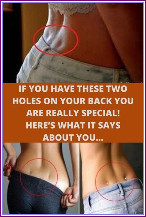 IF YOU HAVE THESE TWO HOLES ON THE BACK YOU ARE REALLY SPECIAL HERES
