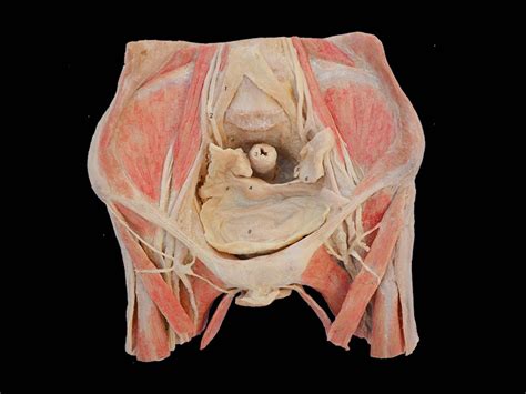 The pelvis in males and females differ from one another in various features, due to functions of the pelvis. Female pelvic organs human body plastination,male pelvis ...