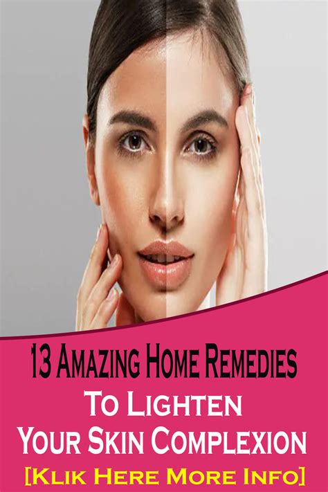 13 Amazing Home Remedies To Lighten Your Skin Complexion